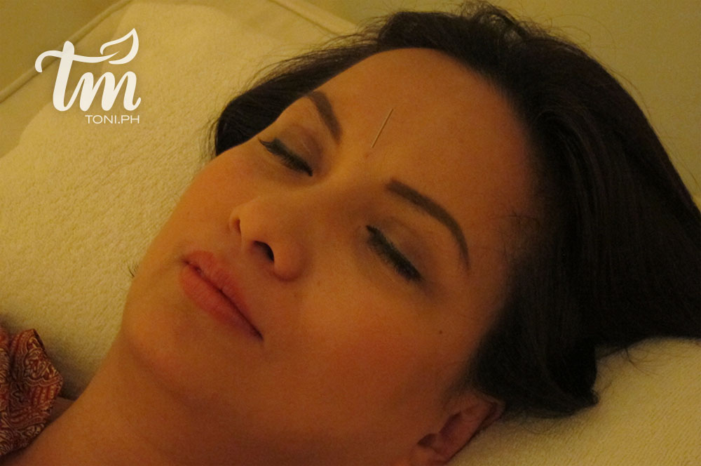 My first acupuncture experience at centro holistico